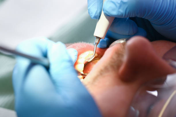 Best Urgent Dental Care for Toothache in Auburn, IN